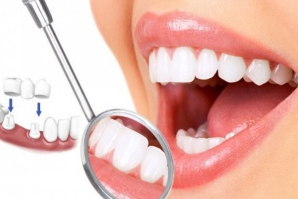 Các yếu tố quan trọng khi lựa chọn vật liệu nha khoa